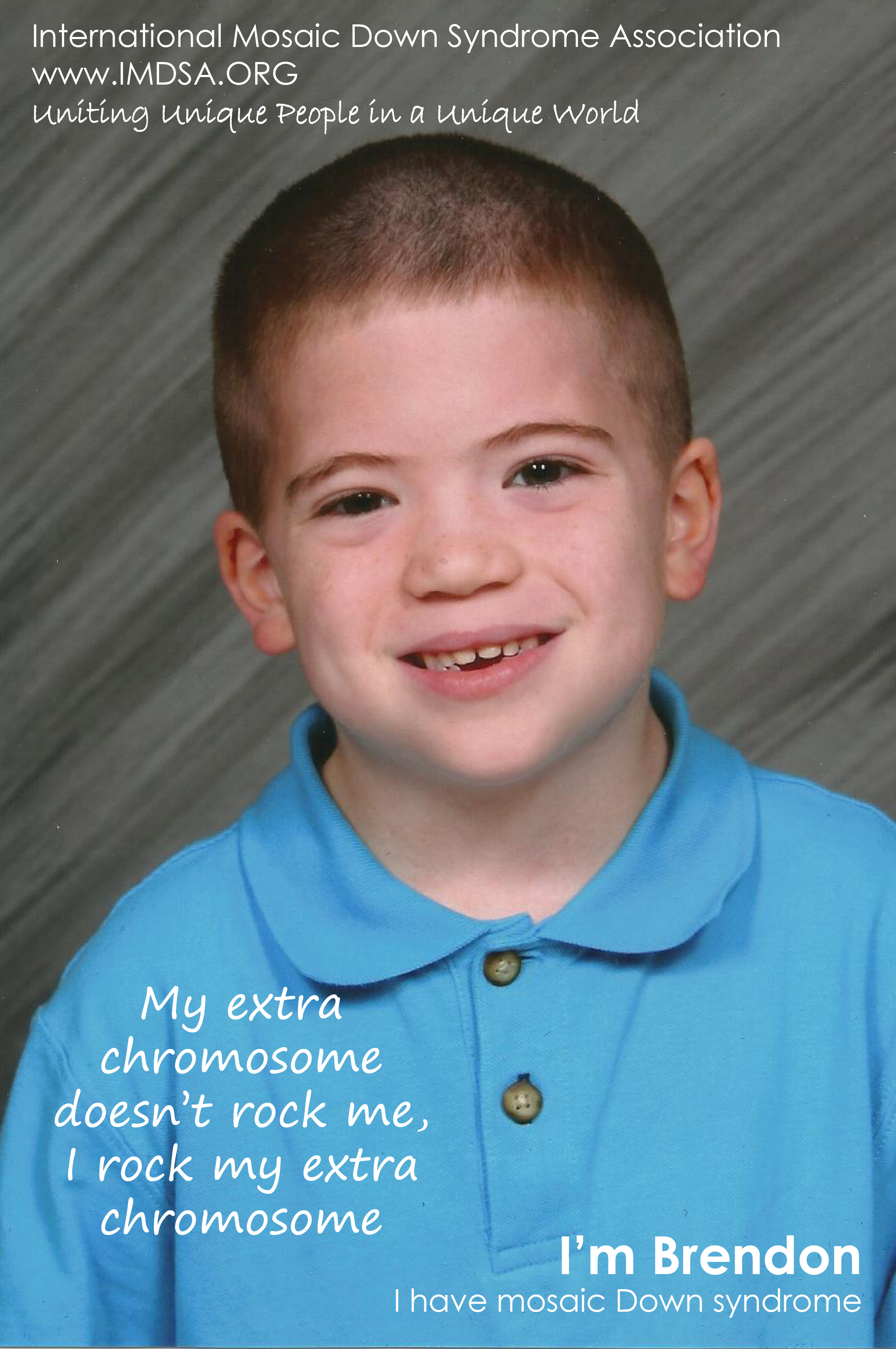 mosaic down syndrome